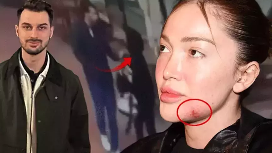 Fenomen Danla Biliç’i darbeden eski sevgilisine 5 ay hapis cezası