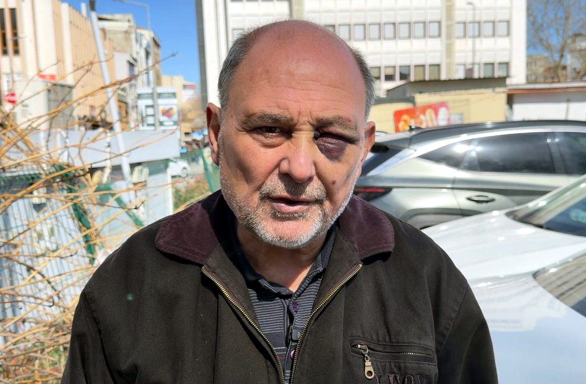 Cenaze Dönüşü Saldırıya Uğrayan Aydın Taksim: "Çift Görüyorum, Şikayetçiyim"
