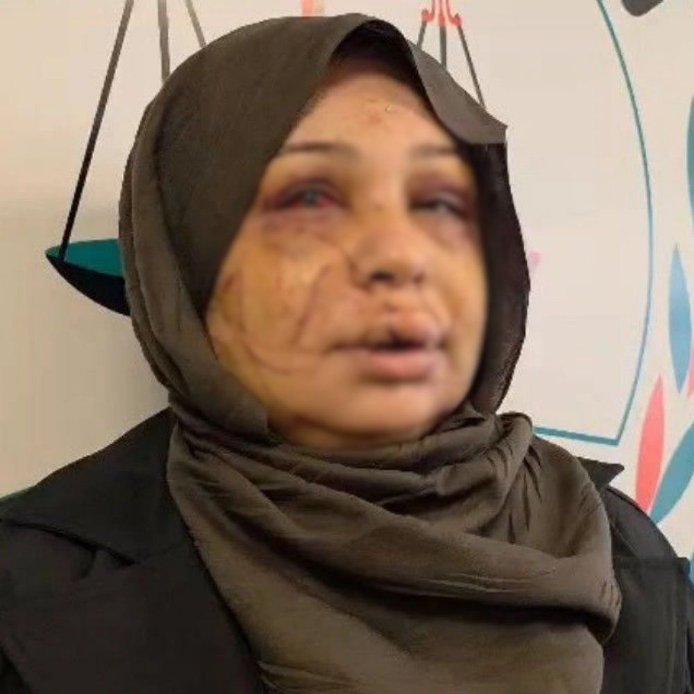 Ankara'da Eşini Yaralayan Polis Memurunun Dosyası Ağır Ceza Mahkemesine Sevk Edildi