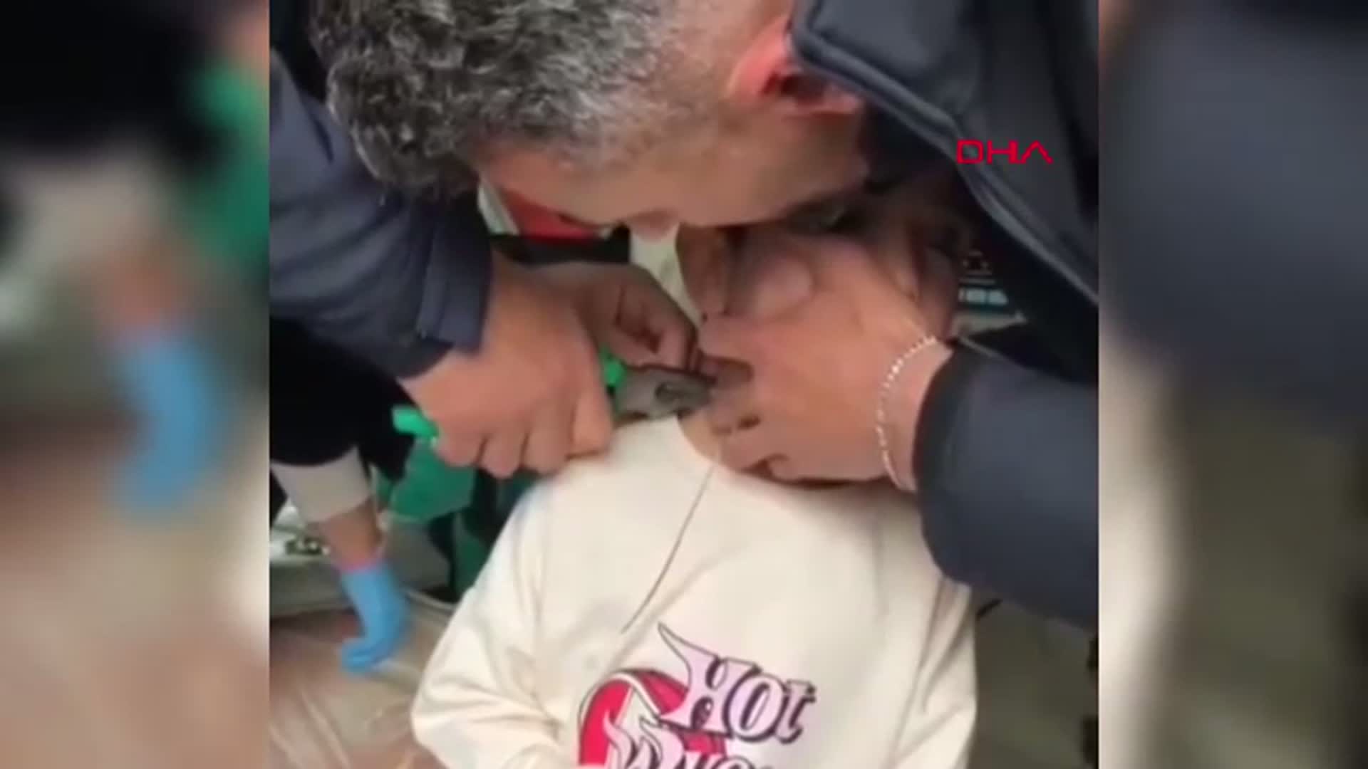 Adıyaman'da Oyun Esnasında Plastikte Kelepçe Takılan Çocuk İtfaiye Ekipleri Tarafından Kurtarıldı