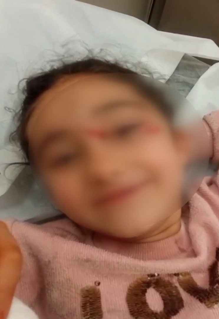İstanbul Eyüpsultan'da Sokak Köpekleri Küçük Kıza Saldırdı