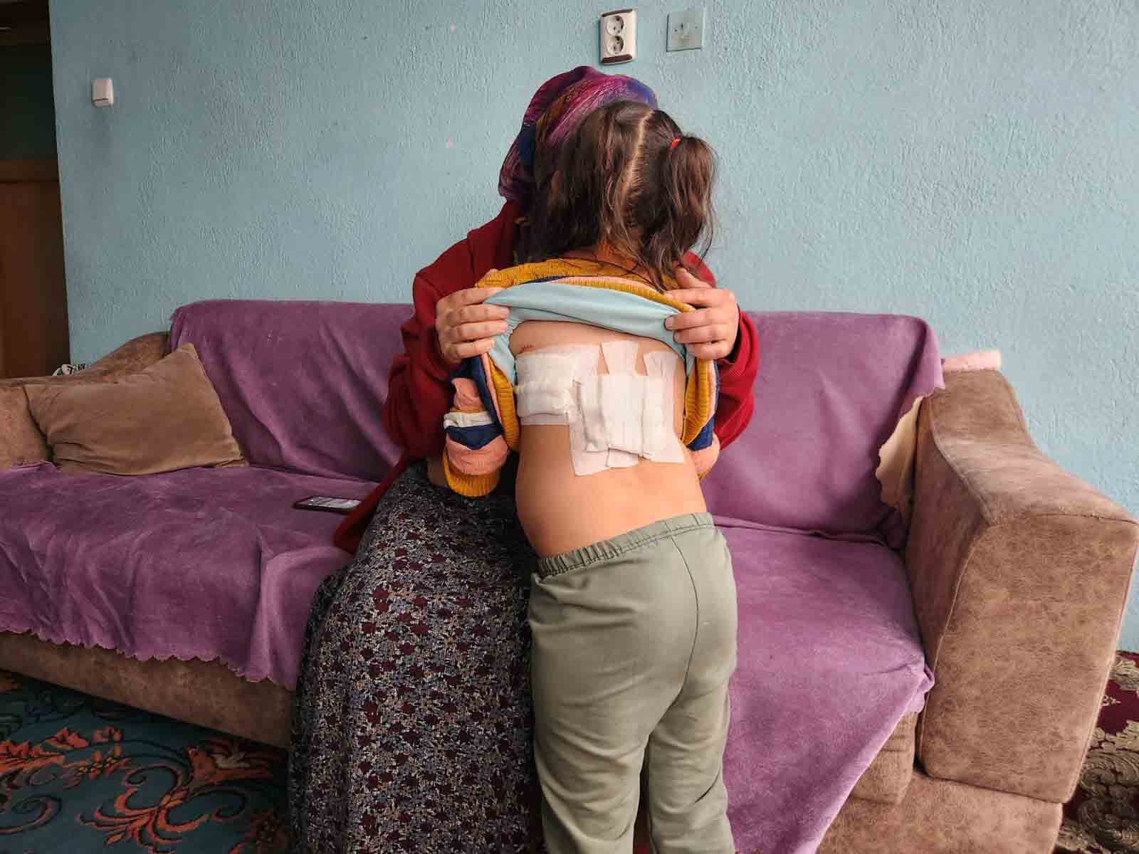 Çocuk Oynarken Eşeğin Saldırısına Uğradı, Anlar Güvenlik Kamerasında