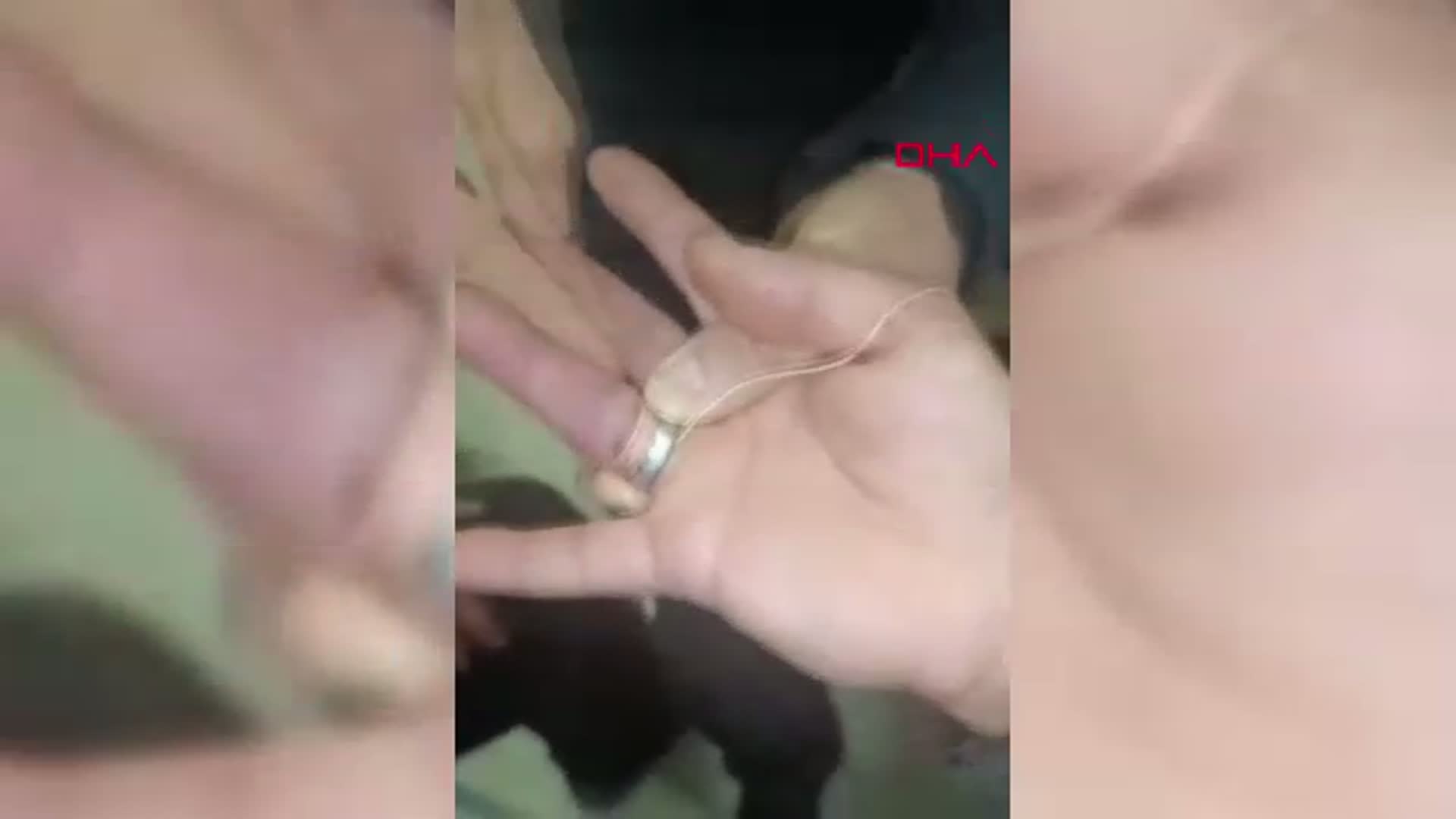 Adıyaman'da Parmağına Sıkışan Yüzük İtfaiye Ekipleri Tarafından Çıkarıldı