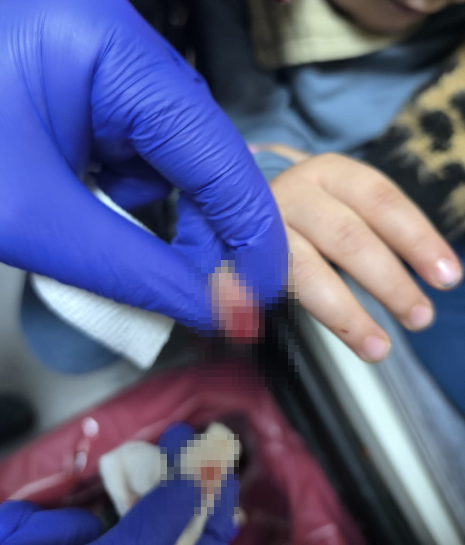 Kızıltepe'de Yürüyen Merdiven Kazası: 3 Yaşındaki Çocuğun Parmağı Koptu
