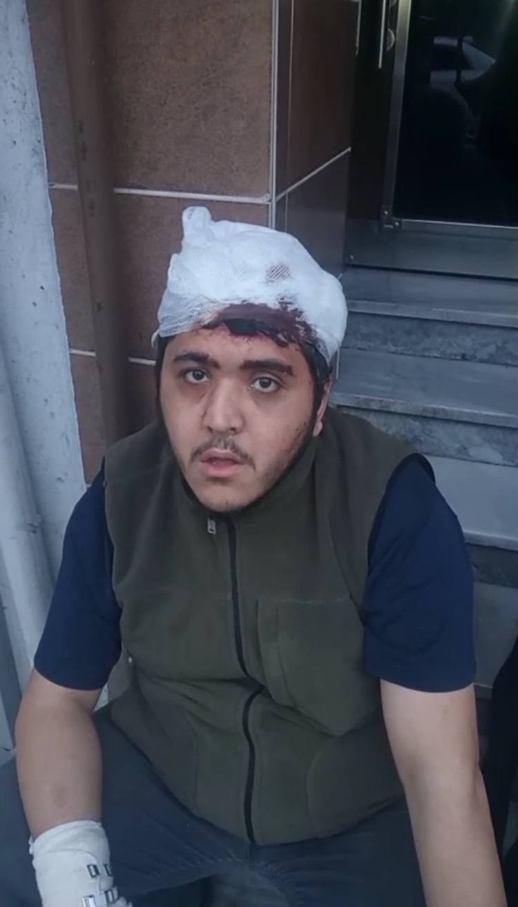 Sultangazi'de Zihinsel Engelli Genç ve Annesine Sopalı Saldırı