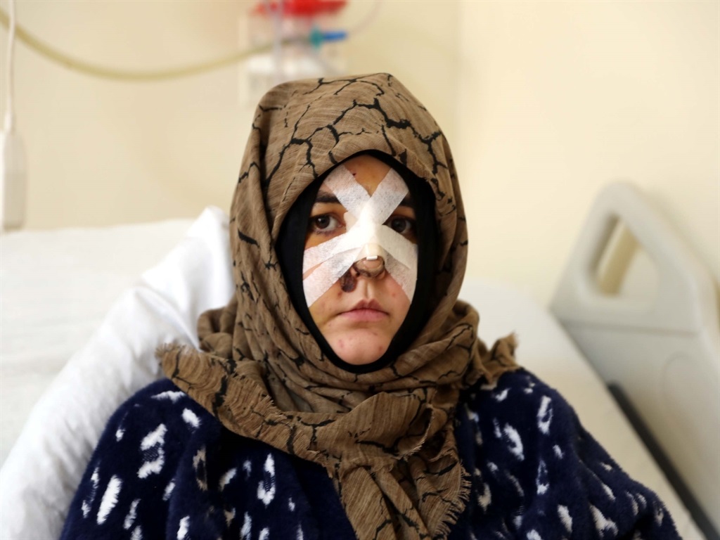 Boşanma Davasında Kaldırım Taşı "Silah" Olarak Değerlendirildi