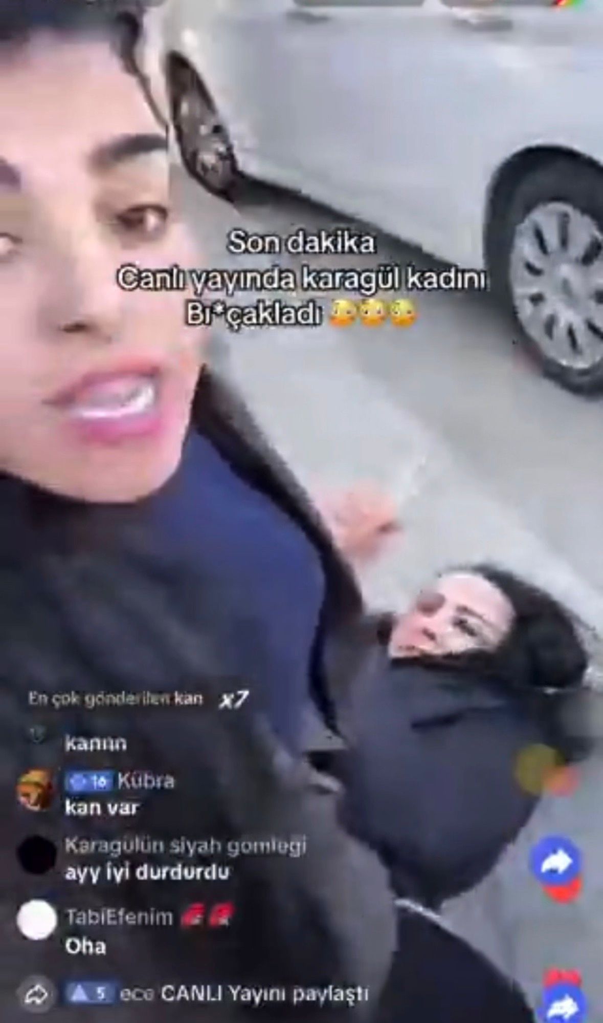 Bursa'da Canlı Yayında Dehşet: Kadının Kulağından Yaralandığı Anlar Kamerada