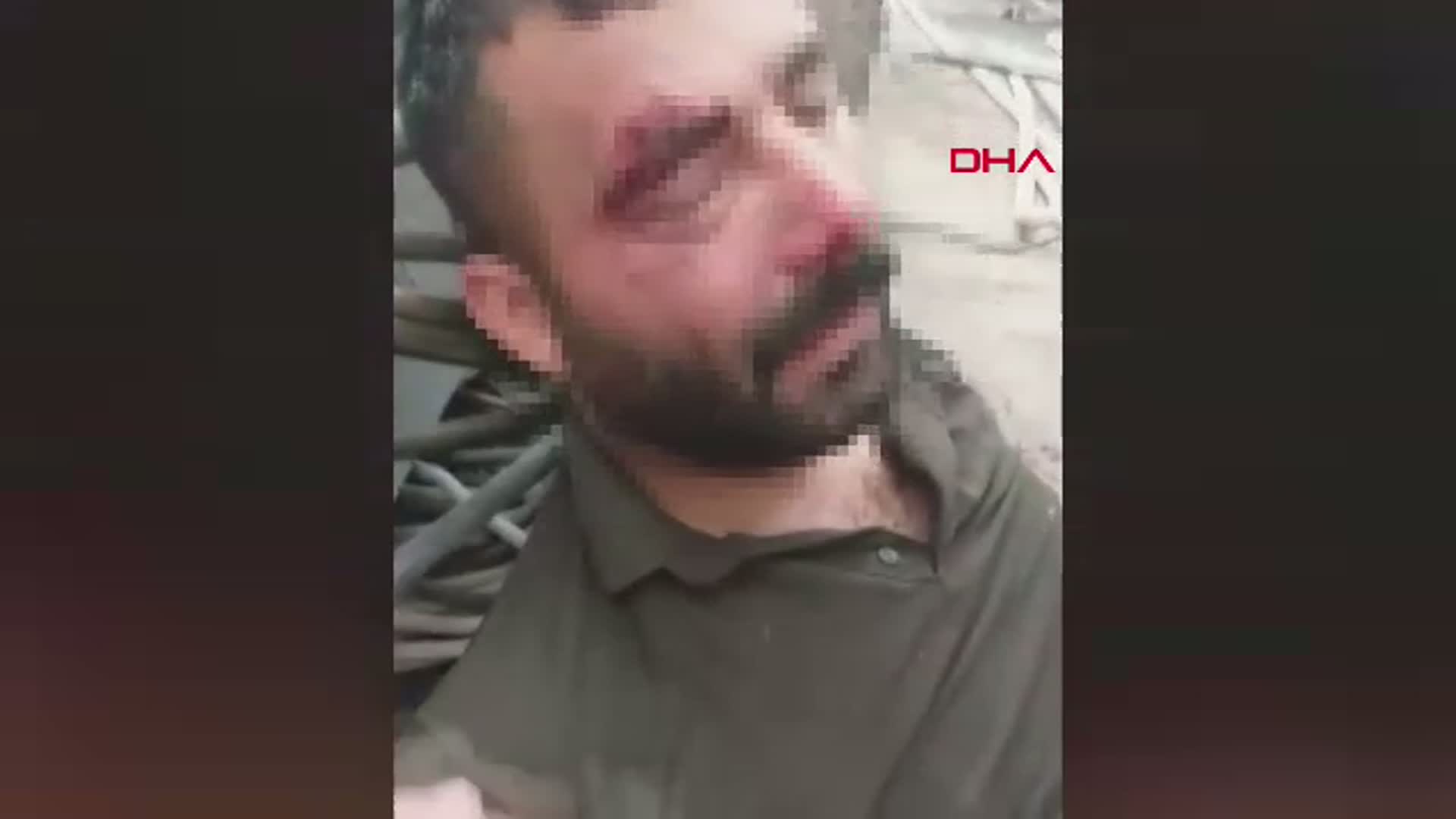 Adana'da Çatıdan Düşen Kaynak Ustasının Hayat Mücadelesi
